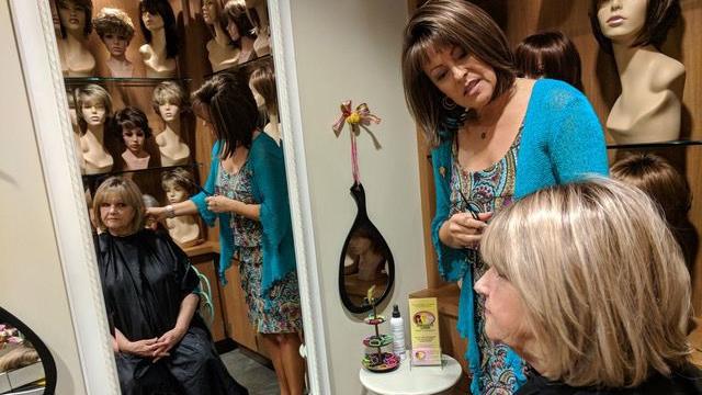 For valley fever survivors, a growing need: Wigs